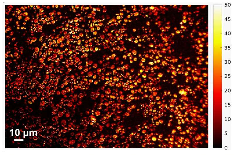 Light it up: Battery particles tell the true story of a battery's charge